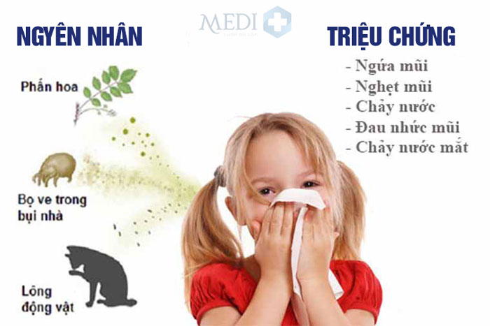 Những nguyên nhân chính gây viêm mũi dị ứng ở trẻ em rất hay gặp