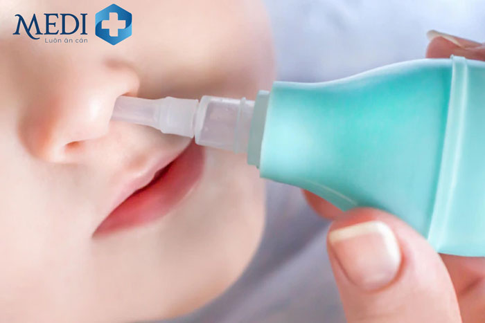 Rửa mũi bằng nước muối sinh lý là cách làm thông dụng nhất được nhiều bố mẹ áp dụng