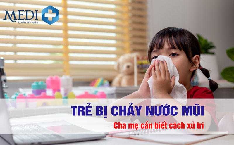 Trẻ bị chảy nước mũi: Mách mẹ kinh nghiệm xử lý