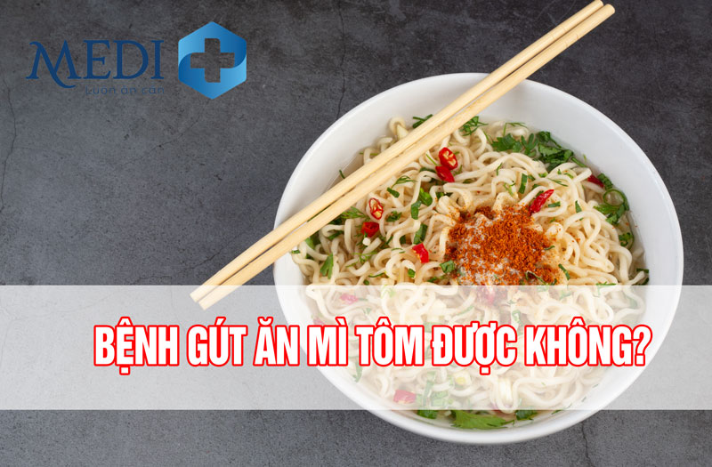 Bệnh gút có ăn được mì tôm không? [HỎI ĐÁP]