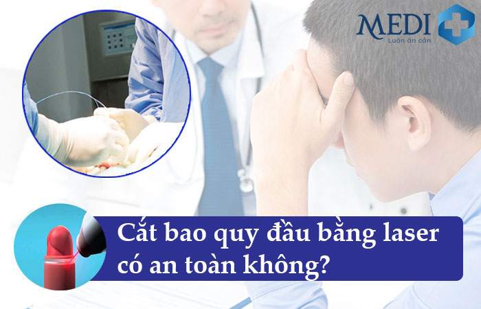 Cắt bao quy đầu bằng laser có an toàn không? Chuyên gia giải đáp