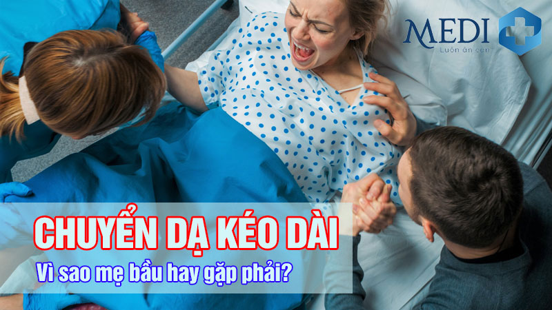 Chuyển dạ kéo dài: Nguyên nhân vì sao mẹ bầu hay gặp?
