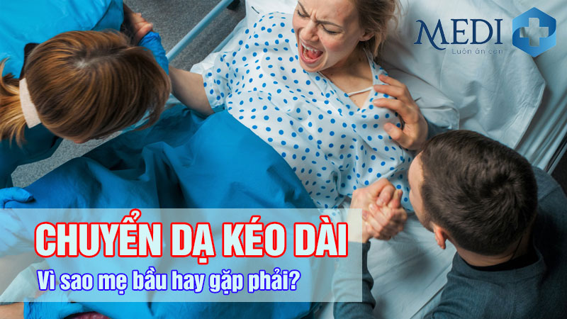 Chuyển dạ kéo dài: Nguyên nhân vì sao mẹ bầu hay gặp?