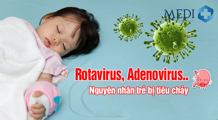 Virus là tác nhân chính và phổ biến gây tiêu chảy nặng và đe dọa tính mạng trẻ