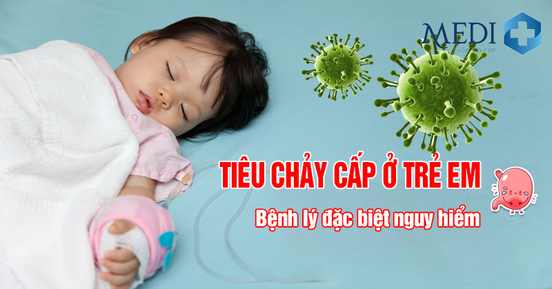 Tiêu chảy cấp ở trẻ em Bác sĩ hướng dẫn mẹ chăm sóc bé tại nhà