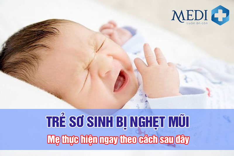 Trẻ sơ sinh bị nghẹt mũi Mẹ thực hiện ngay theo cách sau đây