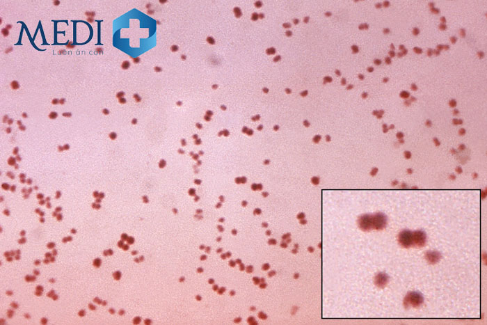 Vi khuẩn lậu cầu bắt màu Gram âm được soi dưới kính hiển vi