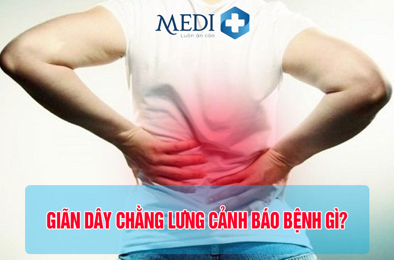 Giãn dây chằng lưng nguyên nhân và cách điều trị hiệu quả