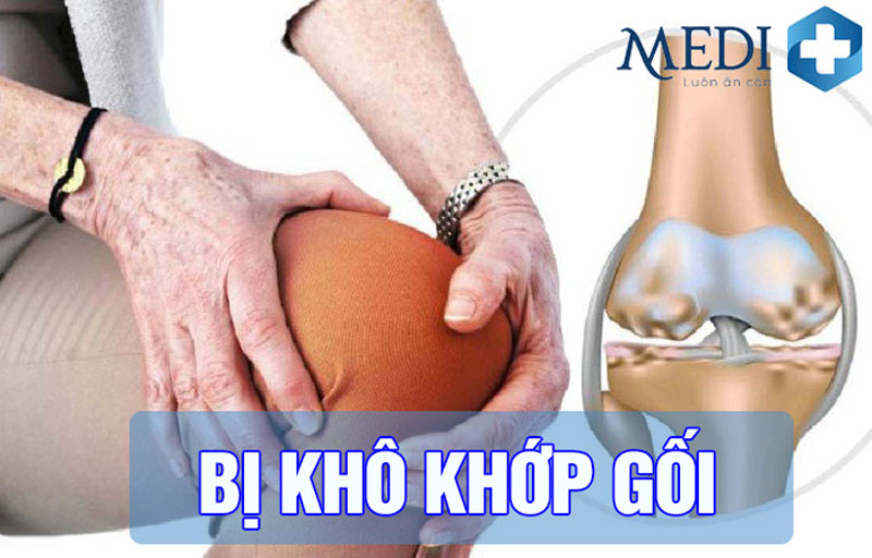 Khô khớp gối: Bệnh do đâu, triệu chứng và cách điều trị