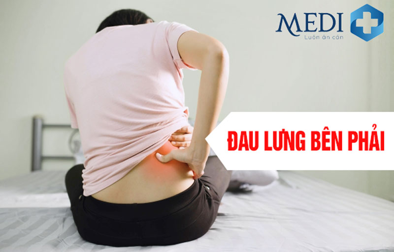 Đau thắt lưng bên phải là gì? Nguyên nhân, chẩn đoán và cách điều trị