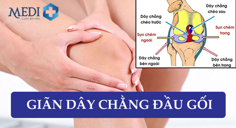 Giãn dây chằng đầu gối: Nguyên nhân & Cách điều trị