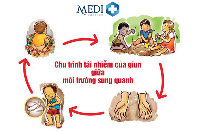 Có nhiều nguyên nhân khiến trẻ bị nhiễm giun sán