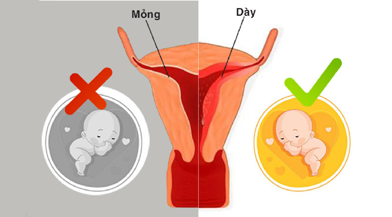 Niêm mạc tử cung dày có ảnh hưởng đến khả năng thụ thai không?