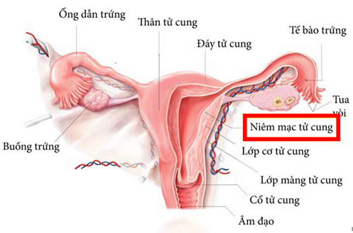 Niêm mạc tử cung là một lớp mô tế bào phủ toàn bộ bề mặt bên trong tử cung