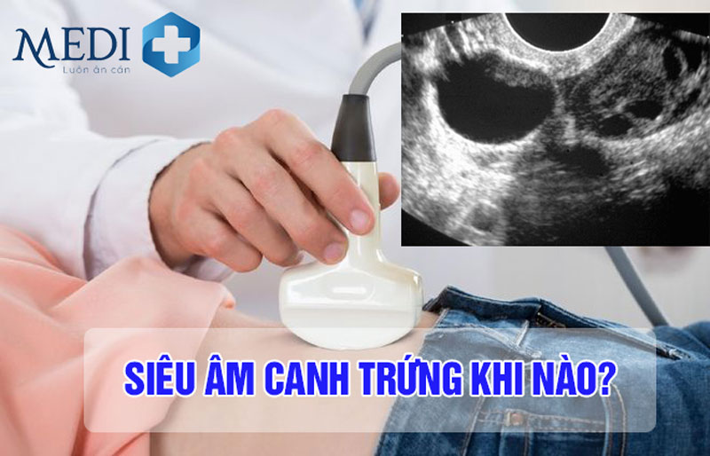 Siêu âm canh trứng thời điểm vàng không nên bỏ qua