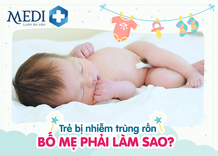 Hình ảnh rốn trẻ sơ sinh bị nhiễm trùng bố mẹ cần lưu ý