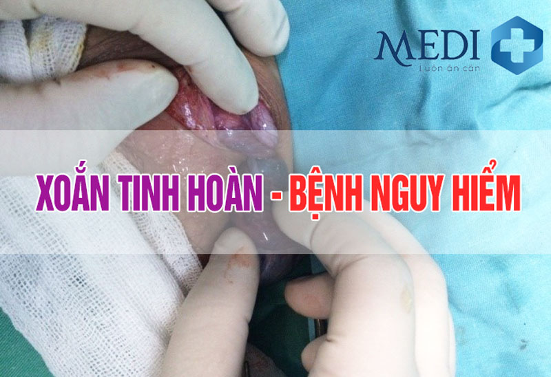 Xoắn tinh hoàn nguy hiểm như thế nào? Nguyên nhân do đâu?