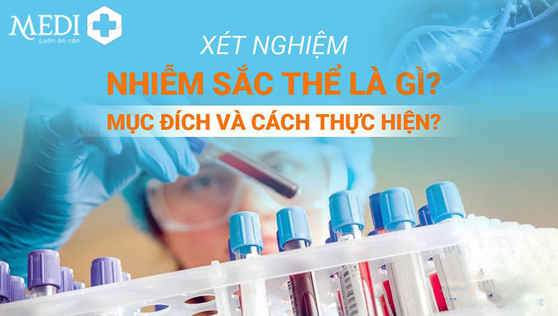 Xét nghiệm nhiễm sắc thể có giúp chẩn đoán vô sinh không?