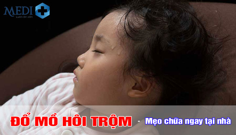 Đổ mồ hôi trộm là bị bệnh gì? Mẹo chữa dân gian tại nhà