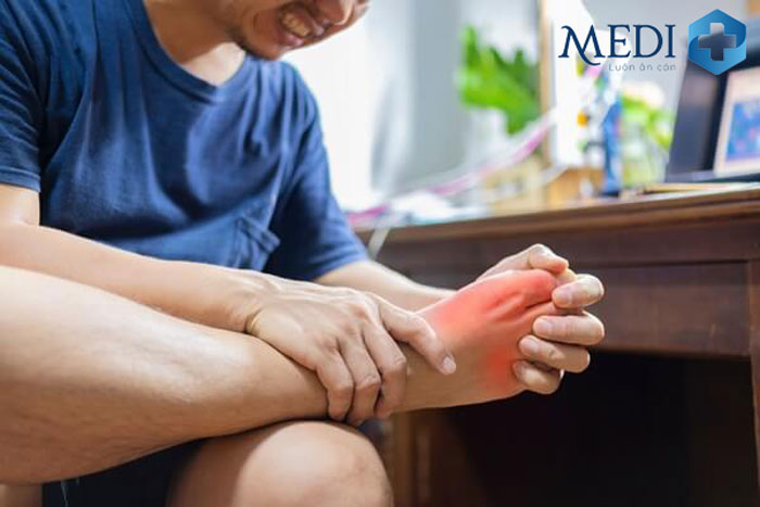 Viêm khớp là một nguyên nhân dẫn đến đau mu bàn chân, thường xảy ra ở những người lớn tuổi