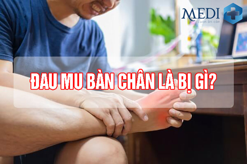 Đau mu bàn chân có phải bị bệnh hay nguyên nhân do đâu?