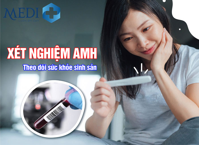 Xét nghiệm chỉ số AMH để kiểm tra sức khoẻ sinh sản