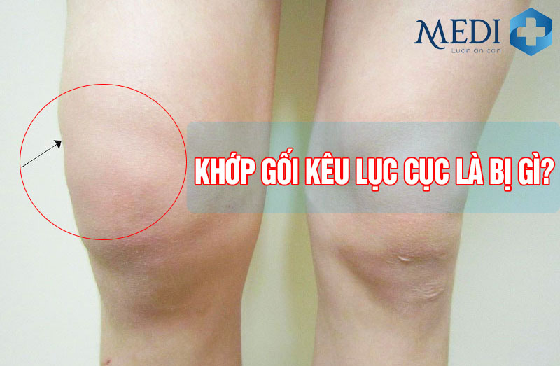 Khớp gối kêu lục cục là bị làm sao có nguy hiểm không?