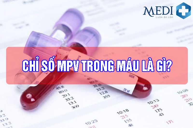 MPV trong máu là gì? Chỉ số thấp hoặc Cao là đang bị làm sao?