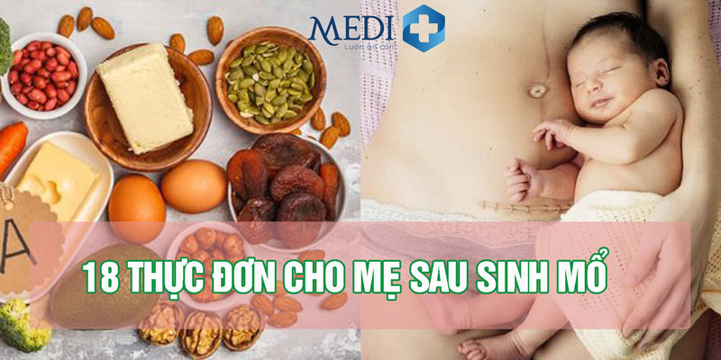 TOP 18 thực đơn cho mẹ sau sinh mổ [Lưu ngay]