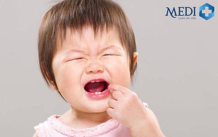 Trẻ hay khóc đêm do mọc răng gây đau nhức và khó chịu