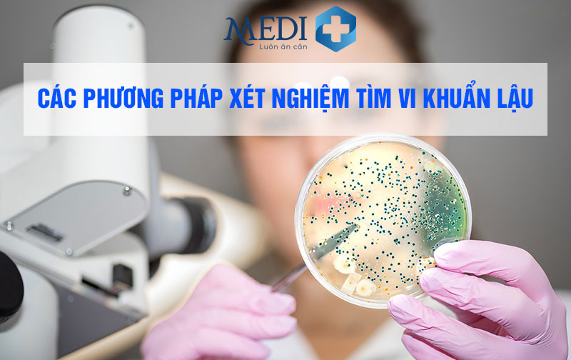 Xét nghiệm bệnh lậu khi nào cần? Quy trình xét nghiệm từ A – Z