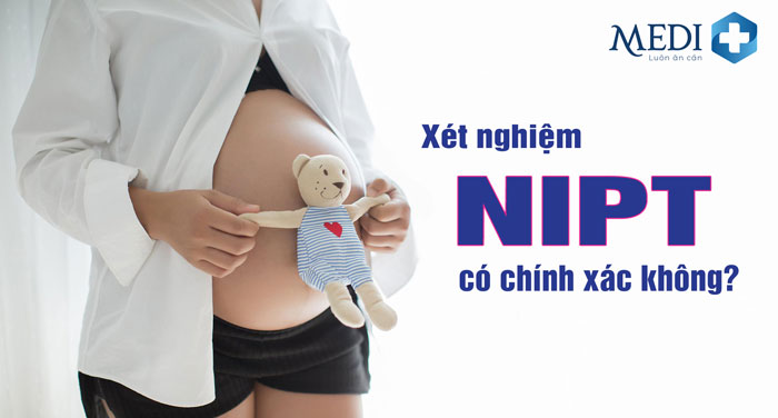 Xét nghiệm NIPT phát hiện bệnh gì và chi phí bao nhiêu?