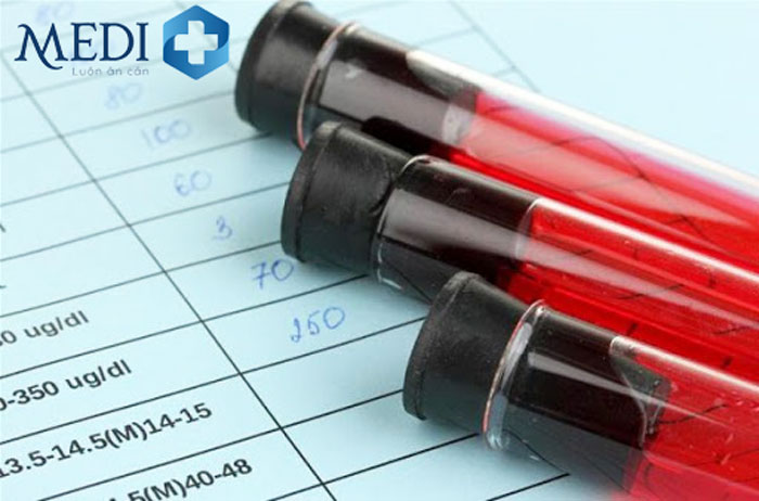Ý nghĩa chỉ số xét nghiệm MPV trong máu