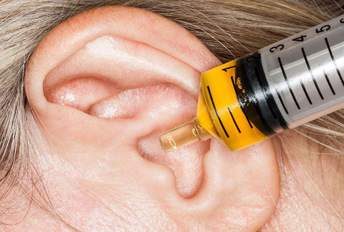Vệ sinh tai đúng cách giúp tránh bị viêm tai giữa nhiễm trùng bên trong.