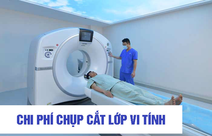 Chụp cắt lớp bao nhiêu tiền? Bảng giá tham khảo một số Bệnh viện