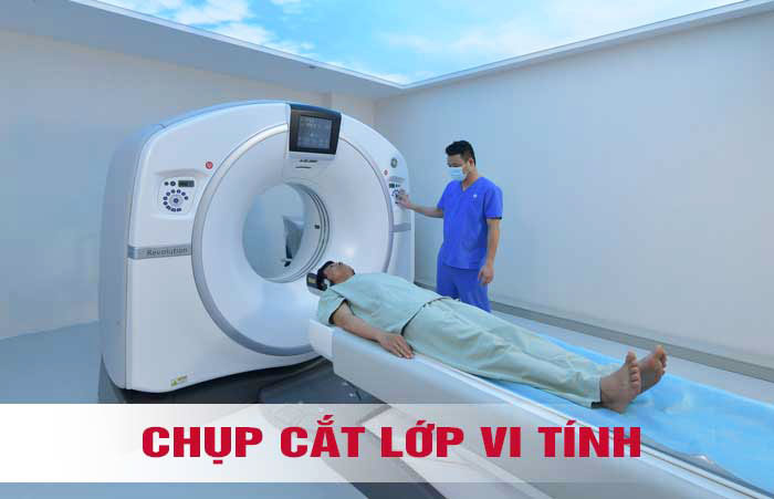 Chụp CT là phương pháp chẩn đoán tình trạng bệnh lý rất hiện đại ngày nay