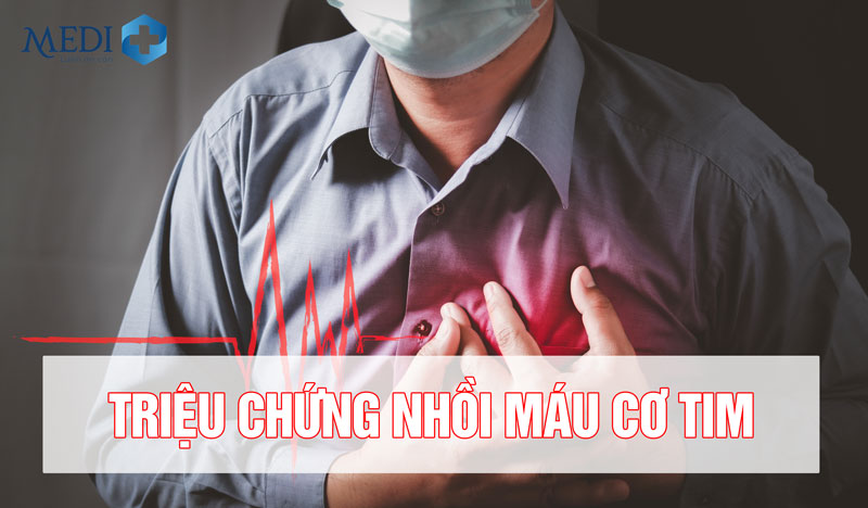 10 dấu hiệu nhồi máu cơ tim chớ “tặc lưỡi” bỏ qua 