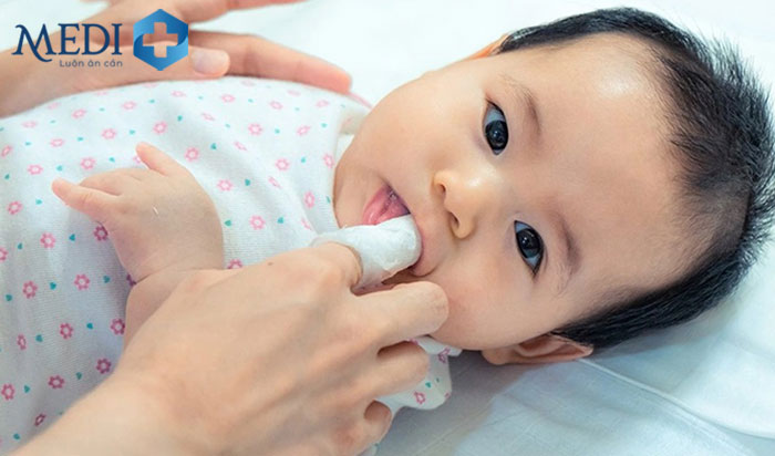Mẹo dân gian hỗ trợ điều trị nấm miệng ở trẻ ngay tại nhà mẹ có thể tham khảo