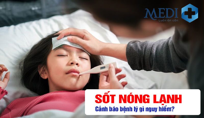 Sốt nóng lạnh cảnh báo bệnh gì, cần lưu ý như thế nào?