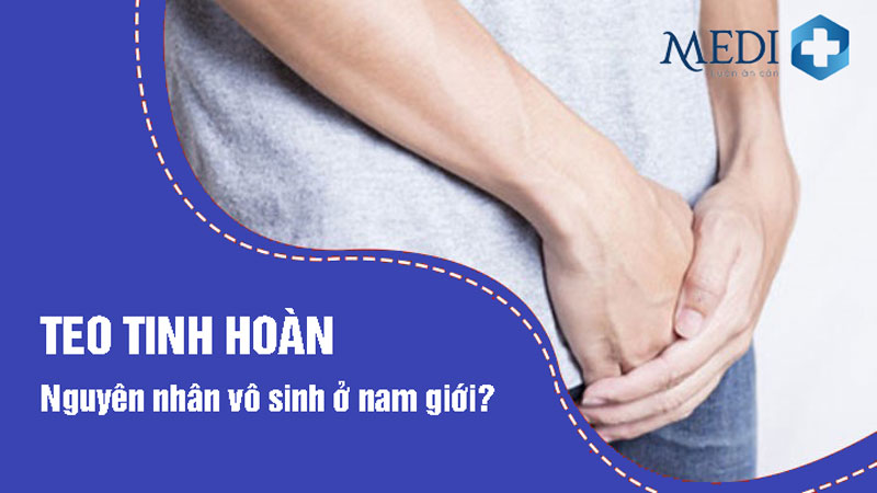 Teo tinh hoàn ở nam giới có gây vô sinh không?