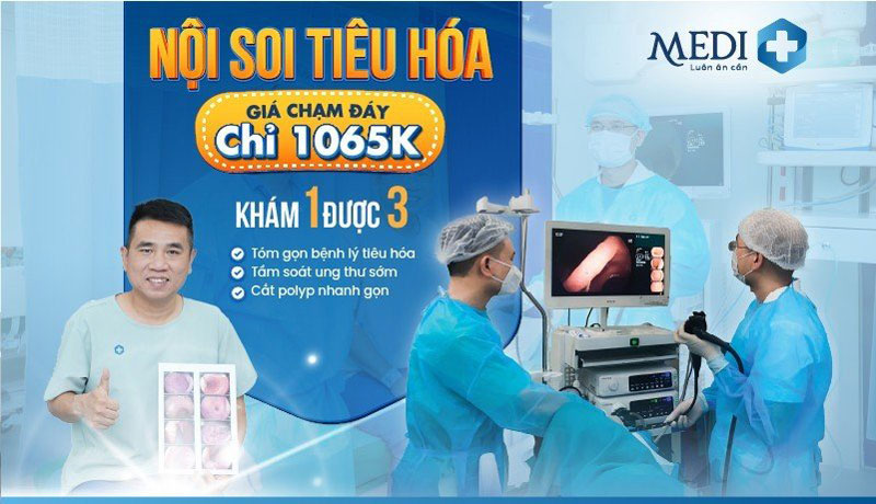 [Hot sale tháng 6] Nội soi dạ dày – Đại tràng chỉ còn 1.065.000đ