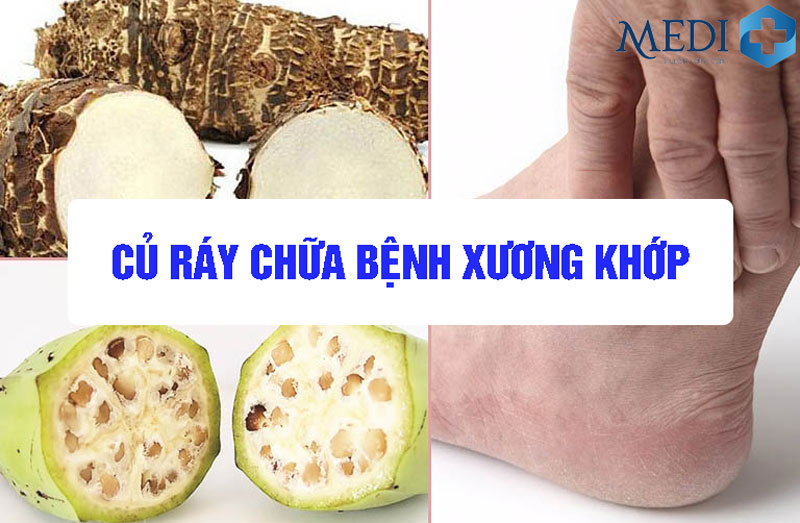 Củ ráy chữa bệnh xương khớp – Cách dùng hiệu quả