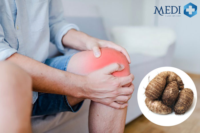 Nên đi khám bác sĩ để điều trị bệnh xương khớp hiệu quả thay vì tự ý sử dụng củ ráy