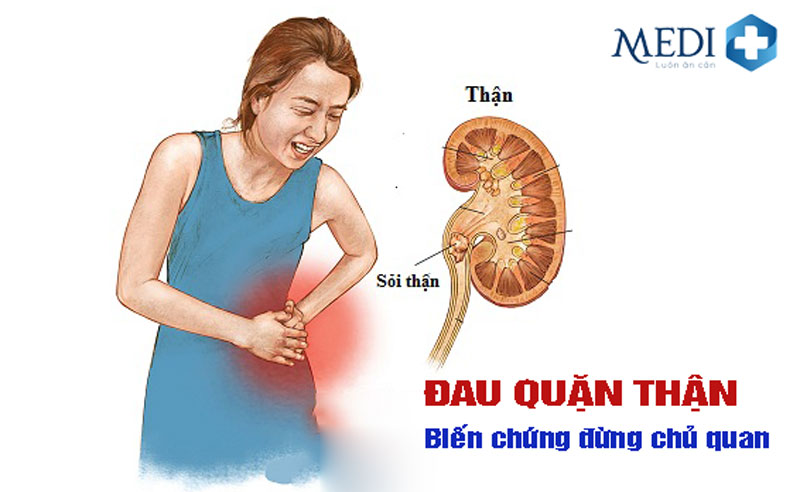 Cơn đau quặn thận do sỏi nhận biết và điều trị đúng cách