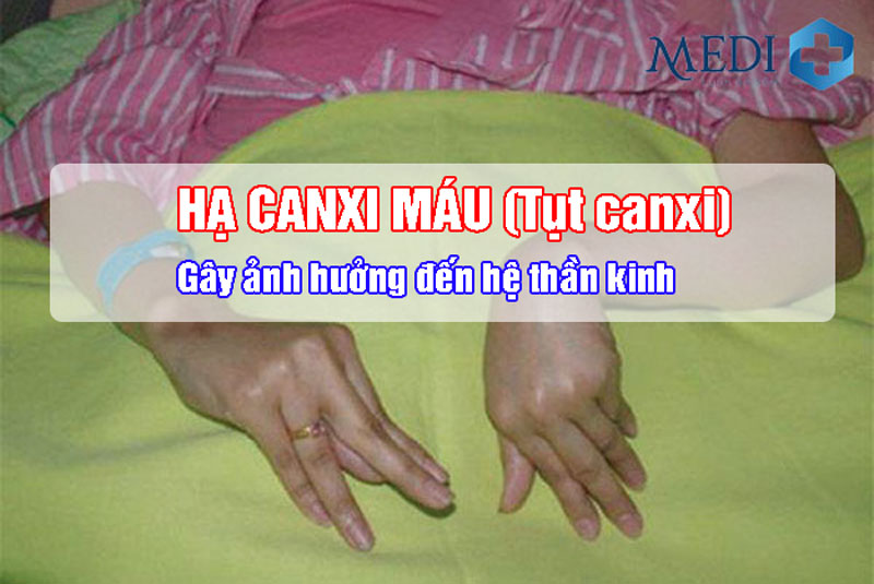 Hạ canxi máu (tụt canxi) là gì? Bệnh có nguy hiểm không?