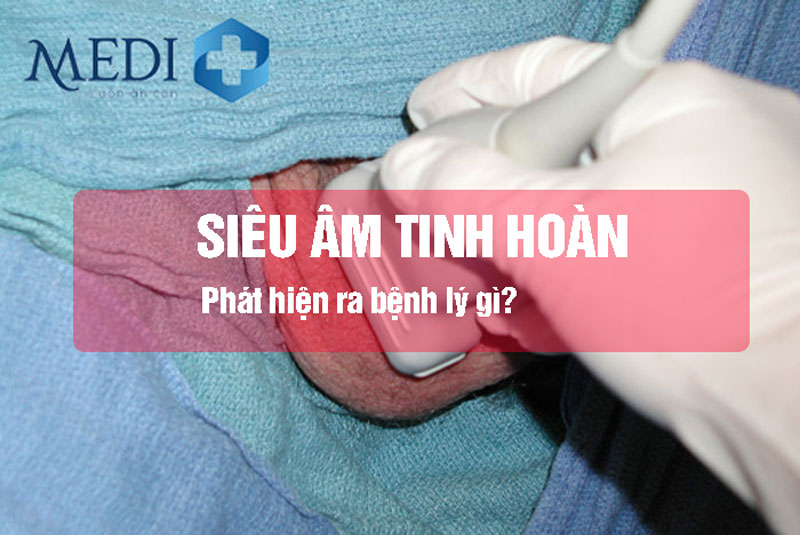 Siêu âm tinh hoàn giúp phát hiện được bệnh gì?