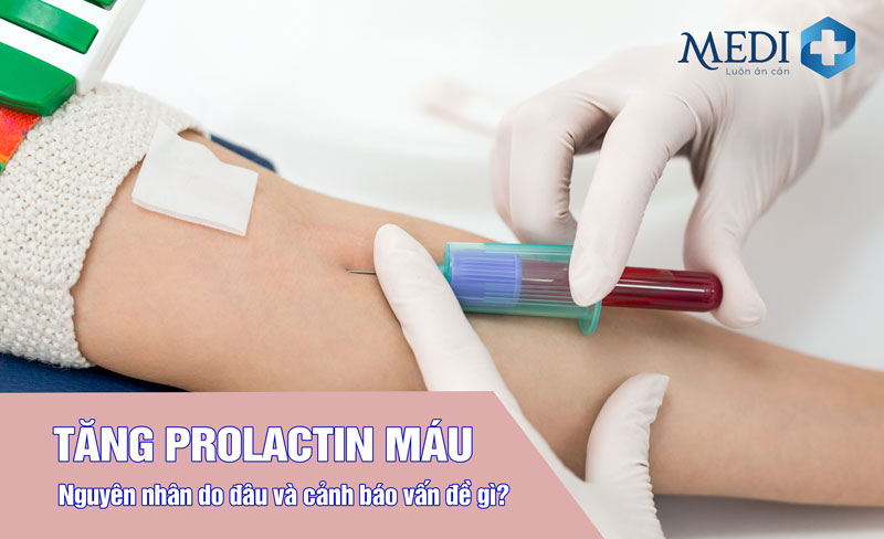 Tăng prolactin máu đang cảnh báo vấn đề sức khỏe nào?