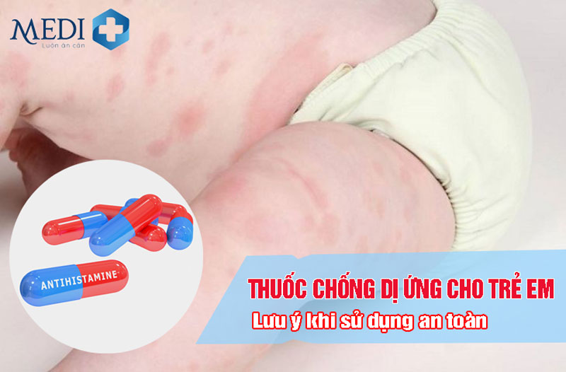 Thuốc chống dị ứng cho trẻ em Lưu ý dùng thế nào cho an toàn