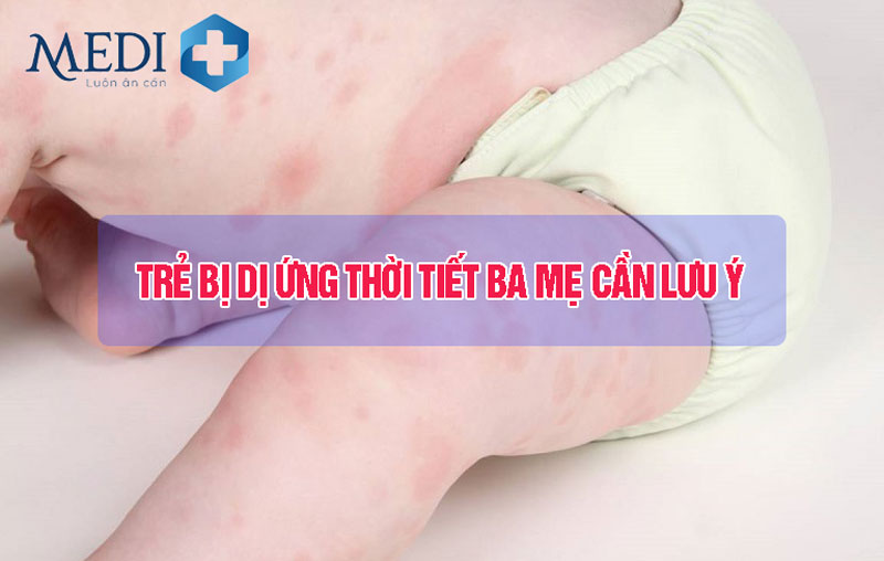 Trẻ bị dị ứng thời tiết, bố mẹ phải làm sao?