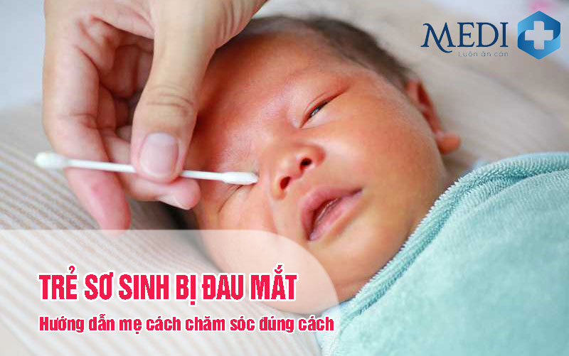 Hướng dẫn bố mẹ chăm sóc trẻ sơ sinh bị đau mắt